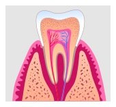 Root Canal Treatment Bellevue, WA 